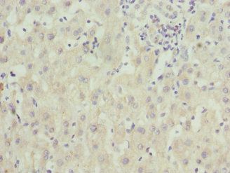 ZNF544 antibody