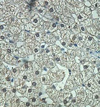 ZNF544 Rabbit Polyclonal Antibody