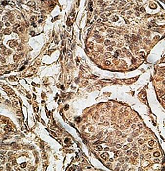 ZNF546 Rabbit Polyclonal Antibody