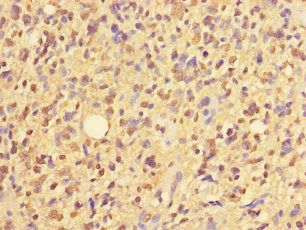 ZNF559 Antibody