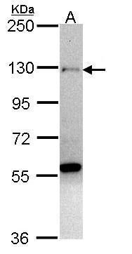 NADH:ubiquinone oxidoreductase subunit S4 Antibody