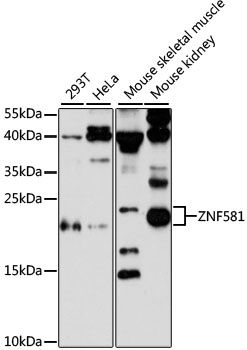 ZNF581 antibody