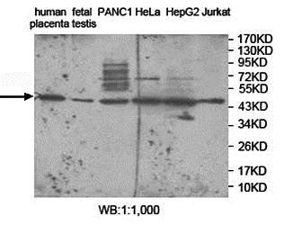 ZNF597 Rabbit Polyclonal Antibody