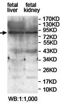 ZNF606 Rabbit Polyclonal Antibody