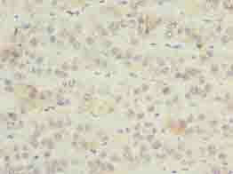 ZNF622 Antibody