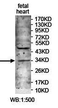 ZNF625 Rabbit Polyclonal Antibody