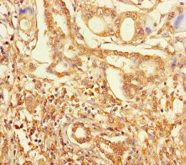 ZNF627 Antibody