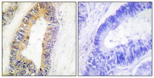 ZNF638 Antibody