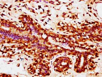 ZNF644 Antibody