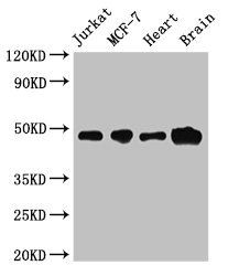 CBLL2 Antibody