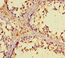 ZNF662 Antibody