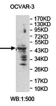 ZNF662 antibody