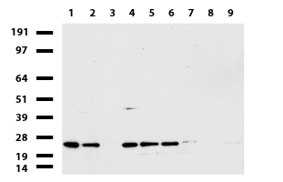 ZNF670 Antibody