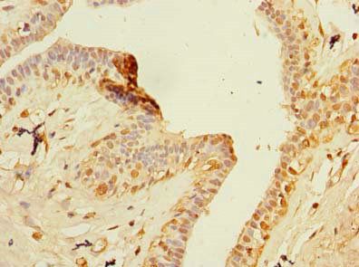 ZNF670 Antibody