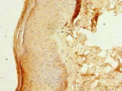 ZNF688 Antibody