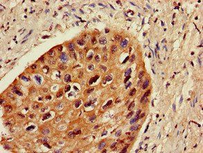 ZNF695 Antibody