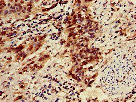 ZNF695 Antibody