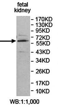 ZNF697 Rabbit Polyclonal Antibody