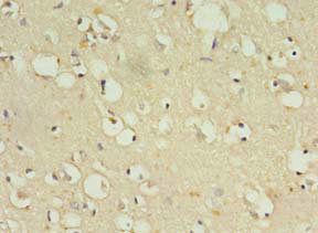 ZNF699 Antibody