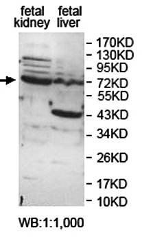 ZNF699 antibody
