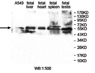 ZNF701 Rabbit Polyclonal Antibody
