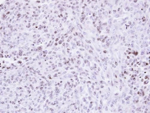 zinc finger protein 707 Antibody