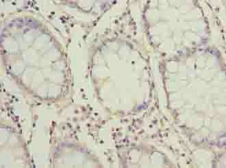 ZNF767P Antibody