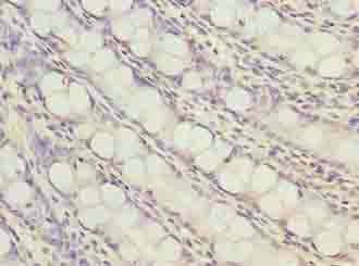 ZNF767P Antibody