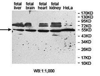 ZNF774 antibody