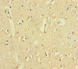 ZNF800 Antibody