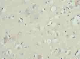 ZNF821 Antibody