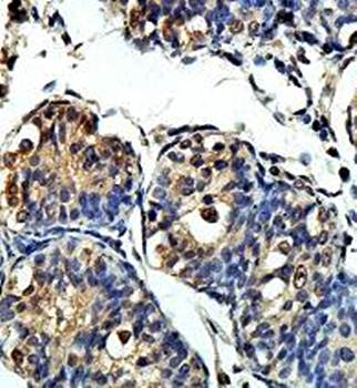 ZNF83 Rabbit Polyclonal Antibody