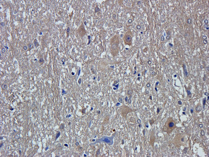 ZNT8 antibody