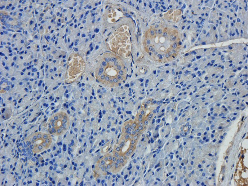 ZNT8 antibody