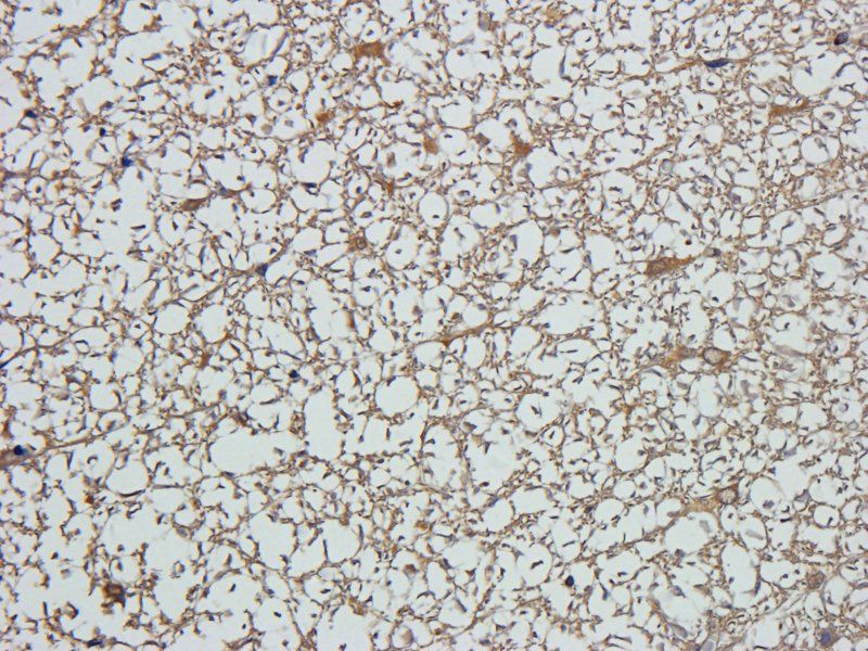 ZNT8 antibody