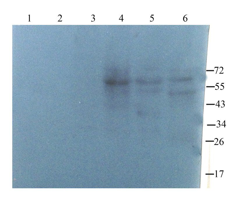 ZNT8 antibody