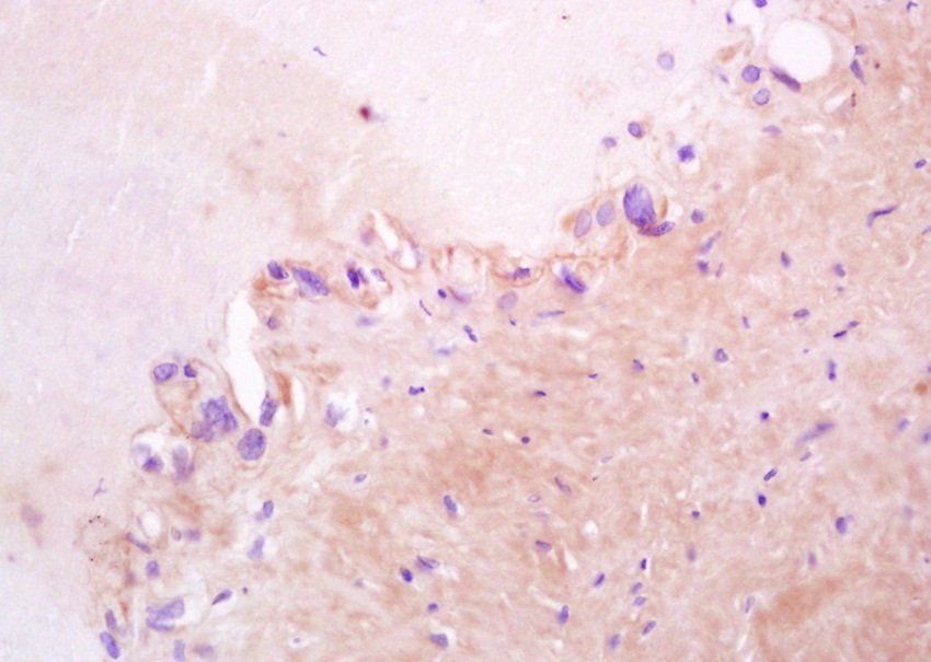 ZO-1 antibody