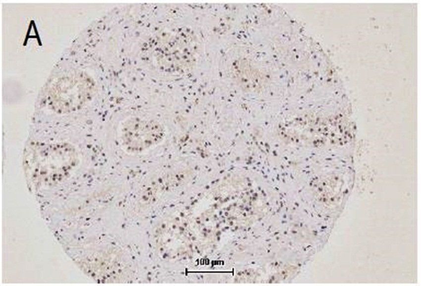 ZO-1 antibody