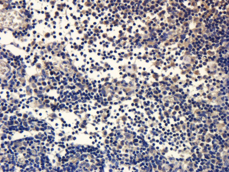 ZO-1 antibody