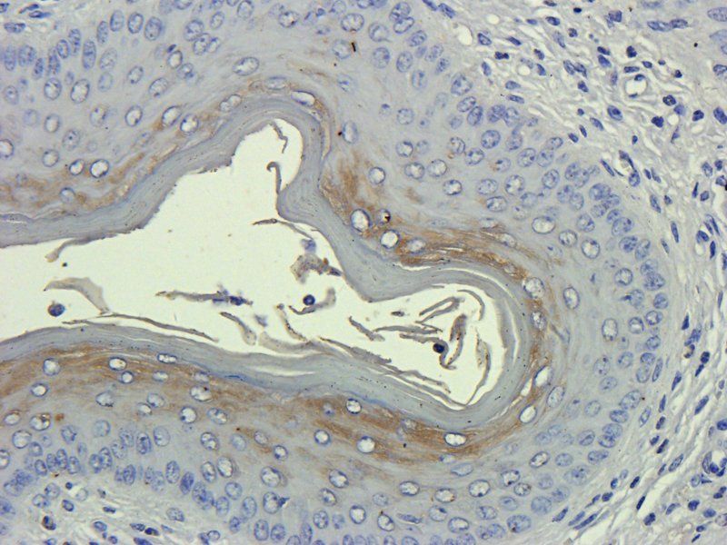 ZO-1 antibody