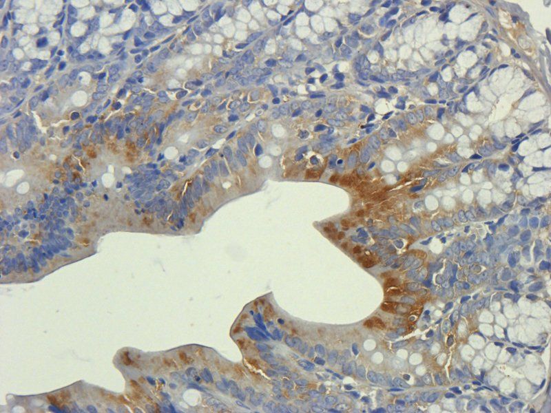 ZO-1 antibody