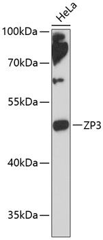 ZP3 antibody