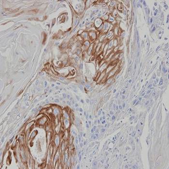 zona pellucida binding protein isoform 1 antibody
