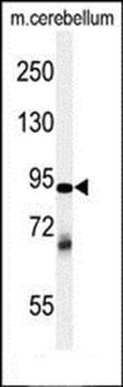 ZRANB1 antibody
