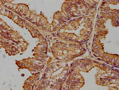 ZRANB1 Antibody