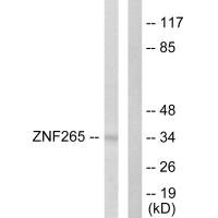 ZRANB2 antibody