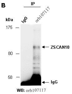 ZSCAN10 (C) Antibody, Rabbit Polyclonal