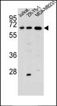 ZSCAN2 antibody