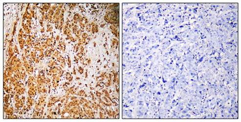 ZSCAN22 antibody