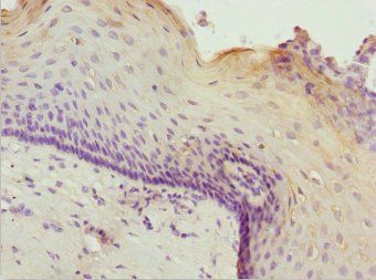 ZSCAN26 Antibody